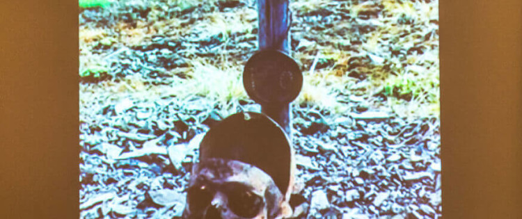 cut-open human skulls